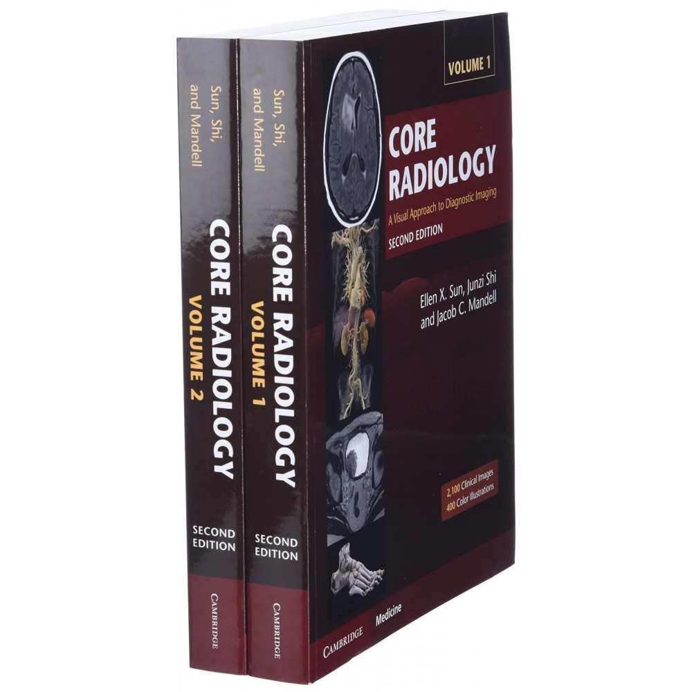 Core Radiology: A Visual Approach to Diagnostic Imaging 2ED