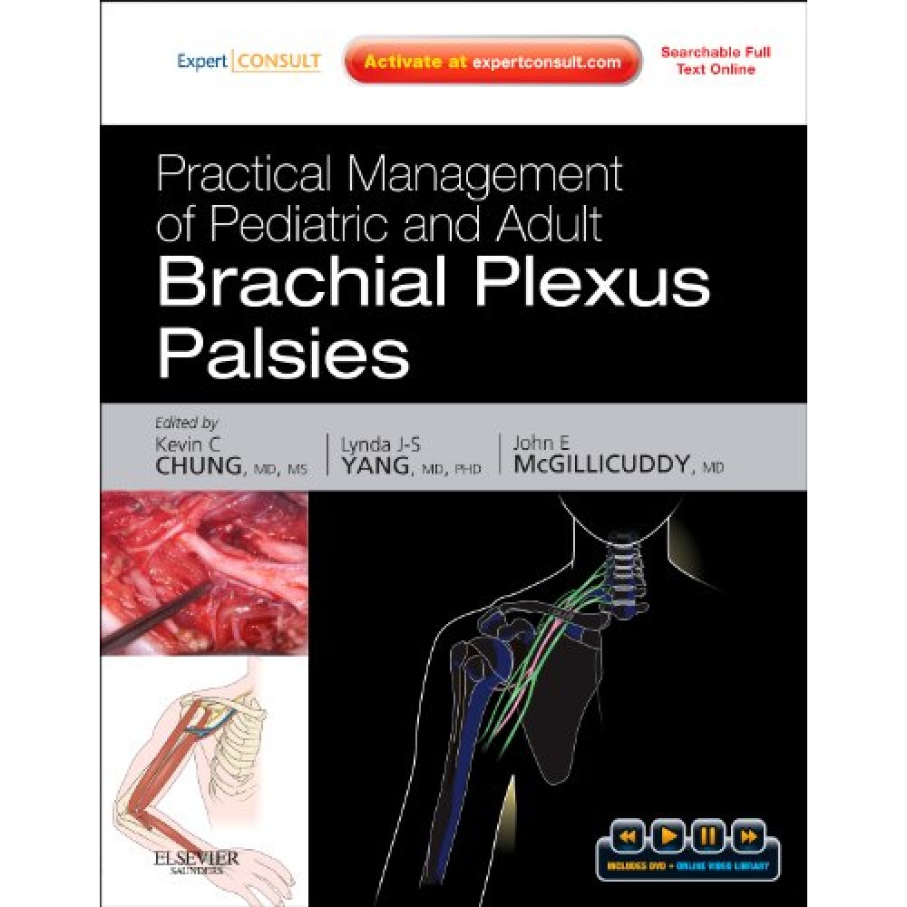 Practical Management of Pediatric and Adult Brachial Plexus Palsies: Expert Consult: Online, Print, and DVD