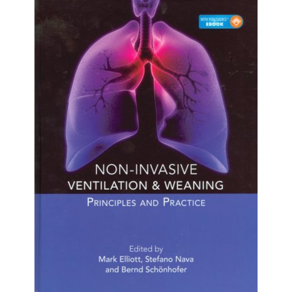 Non-Invasive Ventilation and Weaning: Principles and Practice
