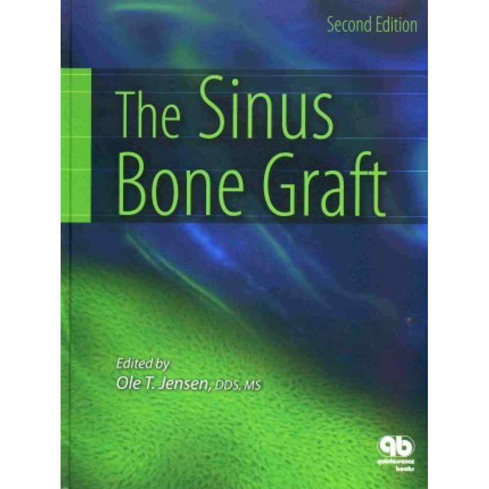 The Sinus Bone Graft