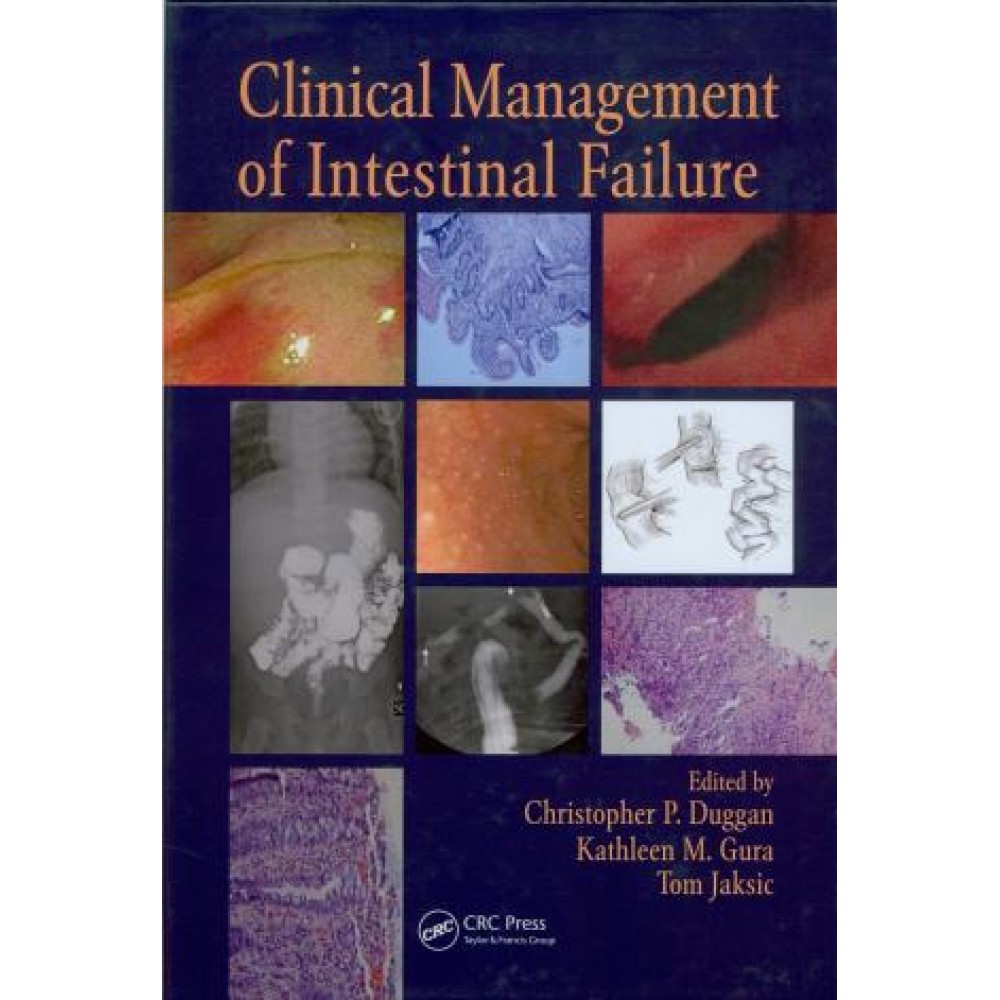 Clinical Management of Intestinal Failure