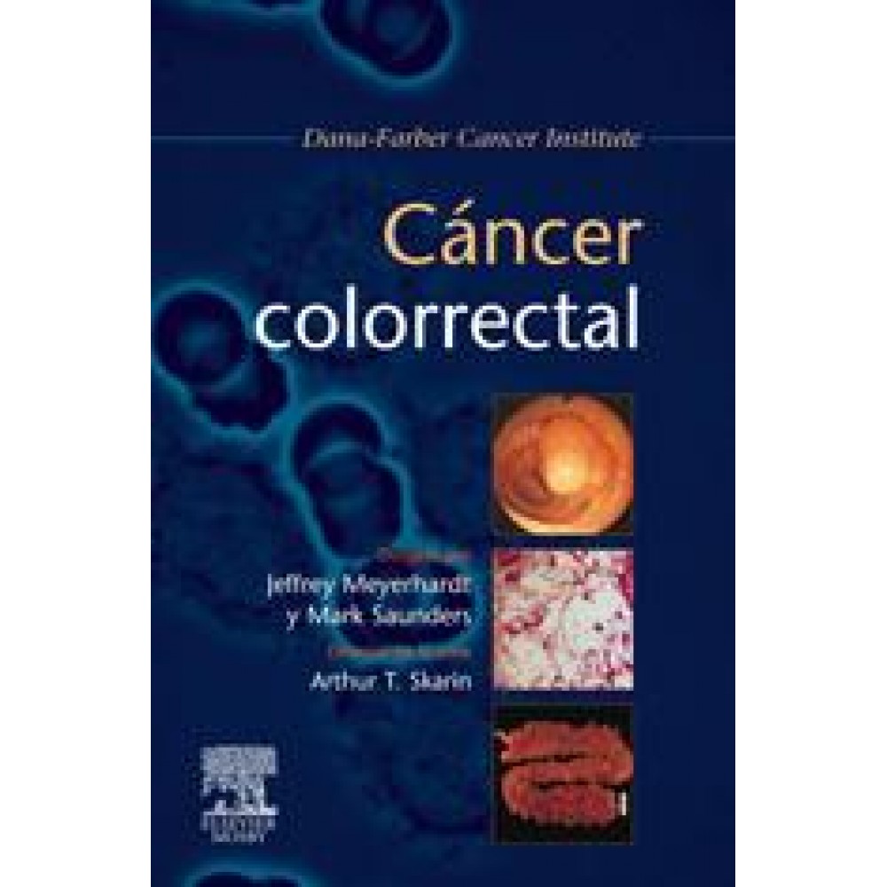 Cáncer Colorrectal