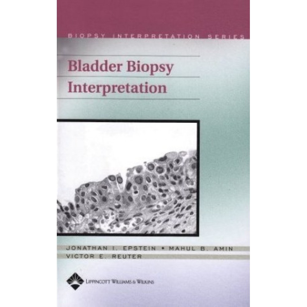 Bladder Biopsy Interpretation