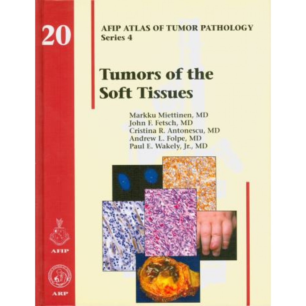 AFIP Atlas of Tumor Pathology: Tumors of the Soft Tissues