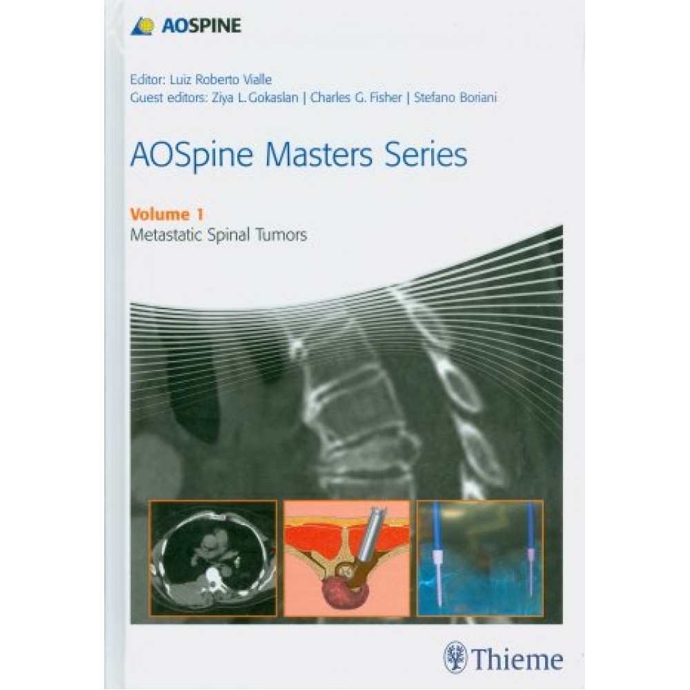 AOSpine Masters Series Vol. 1: Metastatic Spinal Tumors
