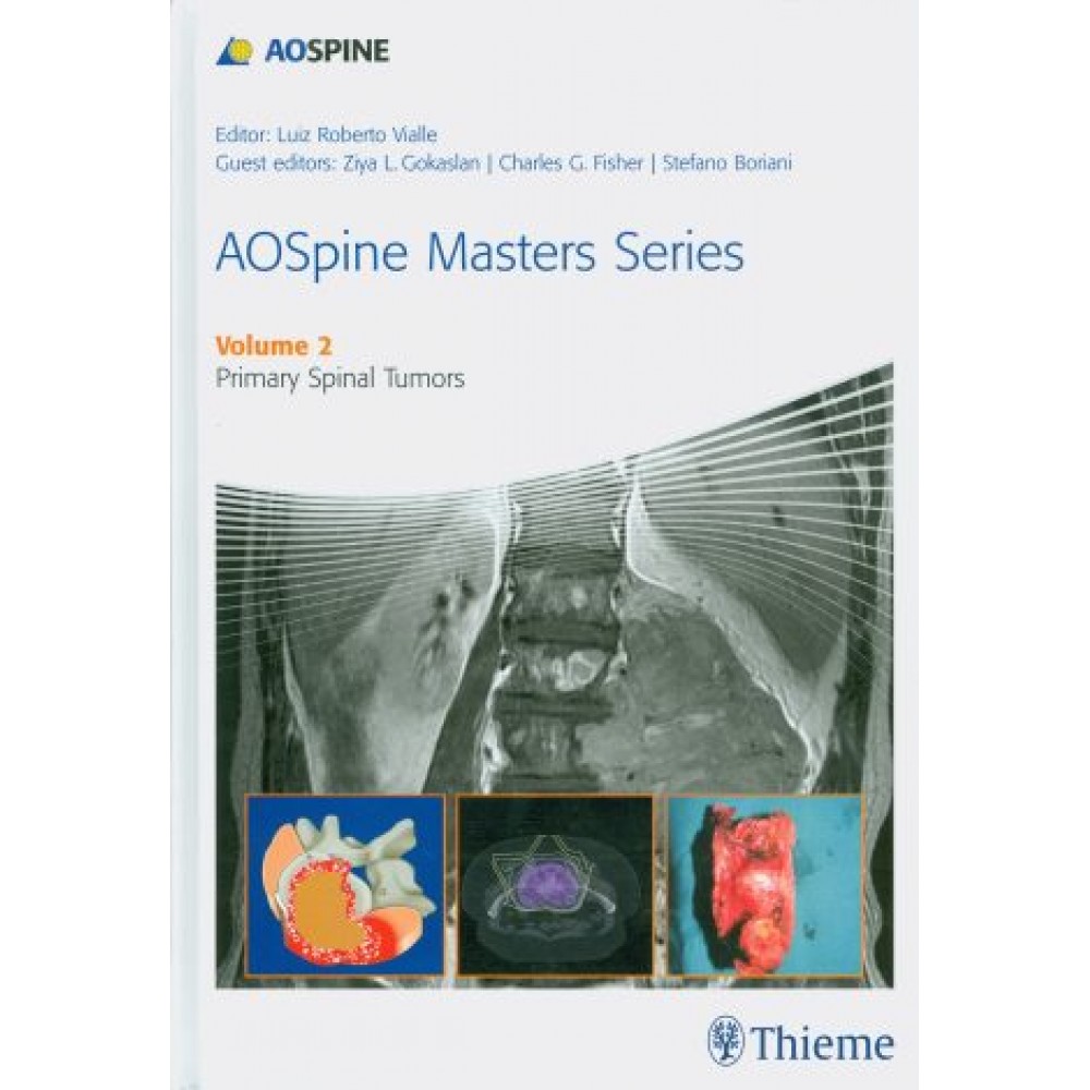 AOSpine Masters Series Vol. 2: Primary Spinal Tumors