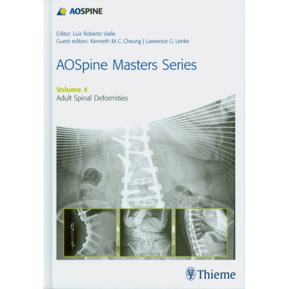 AOSpine Masters Series Vol. 4: Adult Spinal Deformities