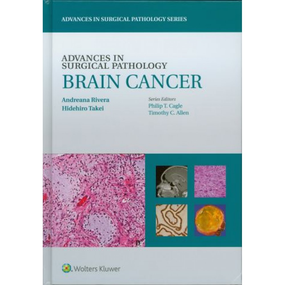 Advances in Surgical Pathology: Brain Cancer