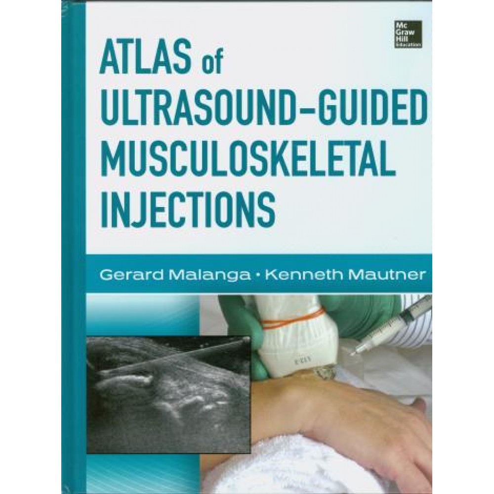 Atlas of Ultrasound-Guided Musculoskeletal Injections
