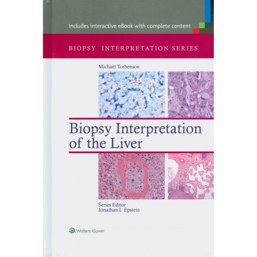 Biopsy Interpretation of the Liver