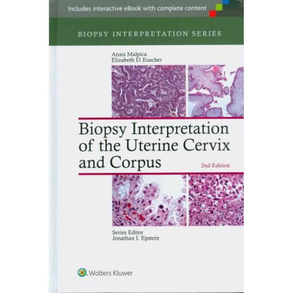 Biopsy Interpretation of the Uterine Cervix and Corpus, 2nd Edition
