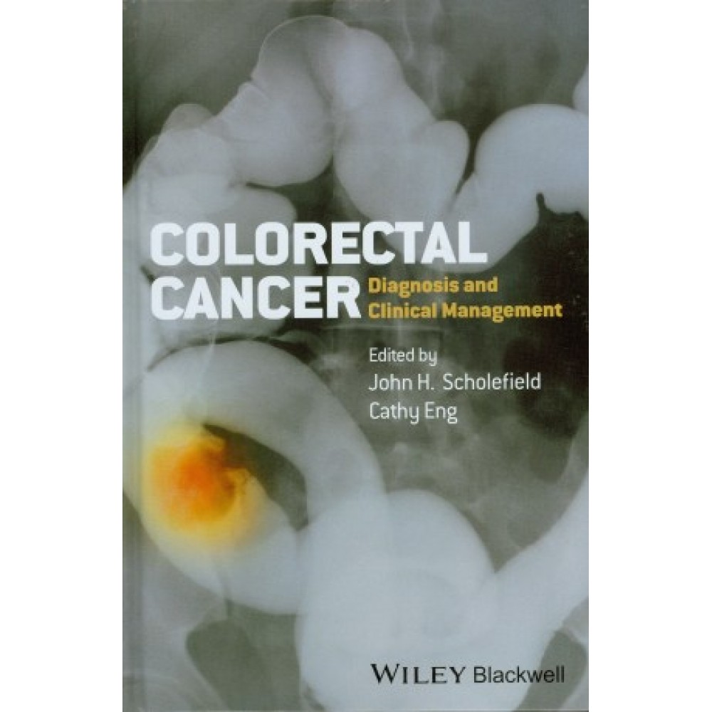 Colorectal Cancer: Diagnosis and Clinical Management