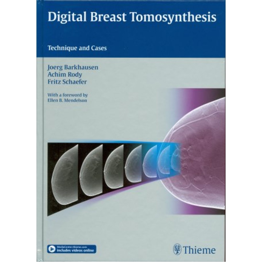 Digital Breast Tomosynthesis