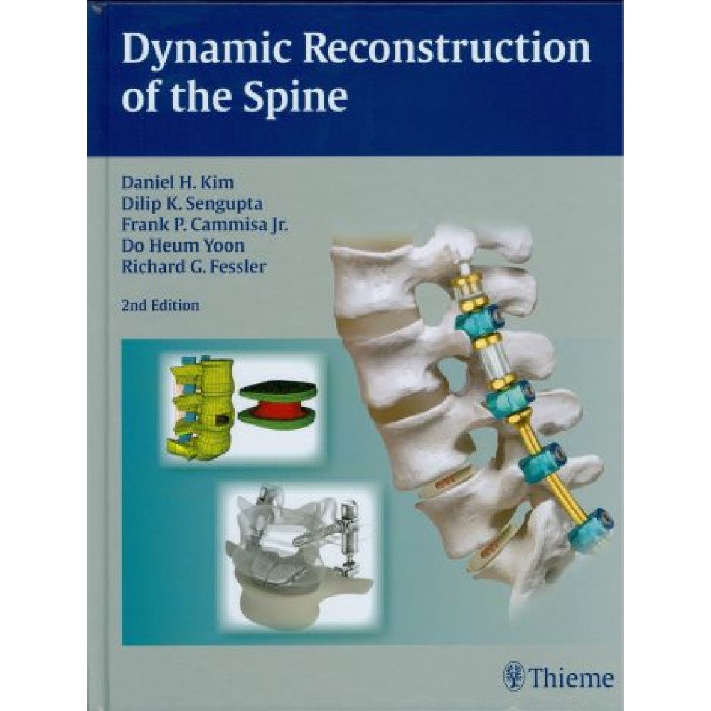 Dynamic Reconstruction of the Spine, 2nd Edition