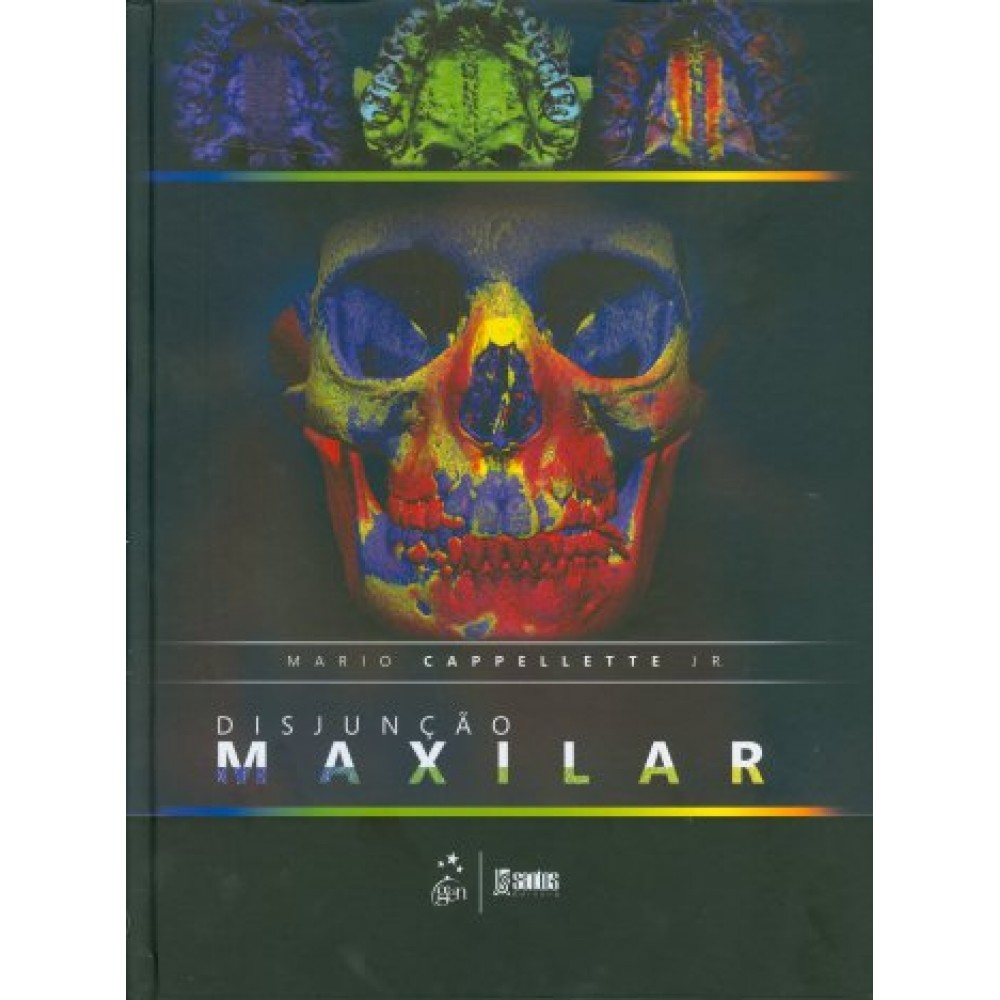 Disjunção Maxilar