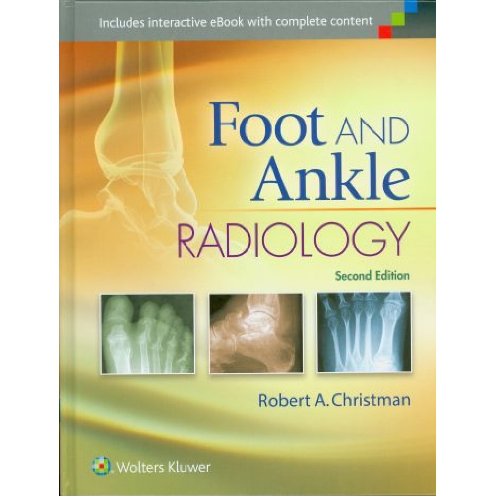 Foot and Ankle Radiology, 2nd Edition