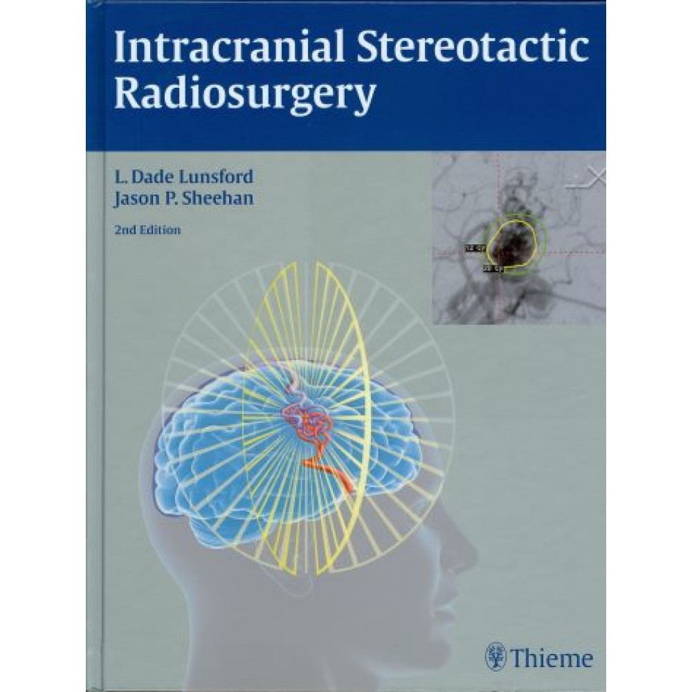 Intracranial Stereotactic Radiosurgery, 2nd Edition