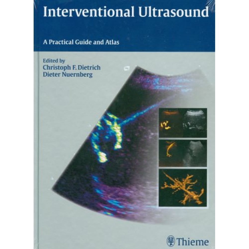 Interventional Ultrasound: A Practical Guide and Atlas