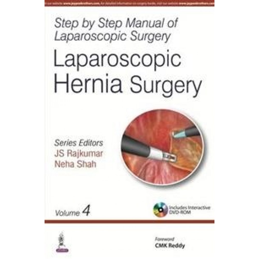 Step by Step Manual of Laparoscopic Surgery: Laparoscopic Hernia Surgery