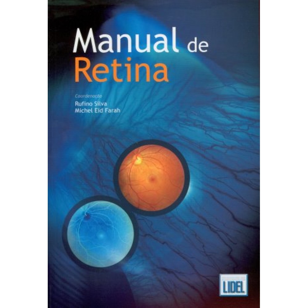 Manual de Retina