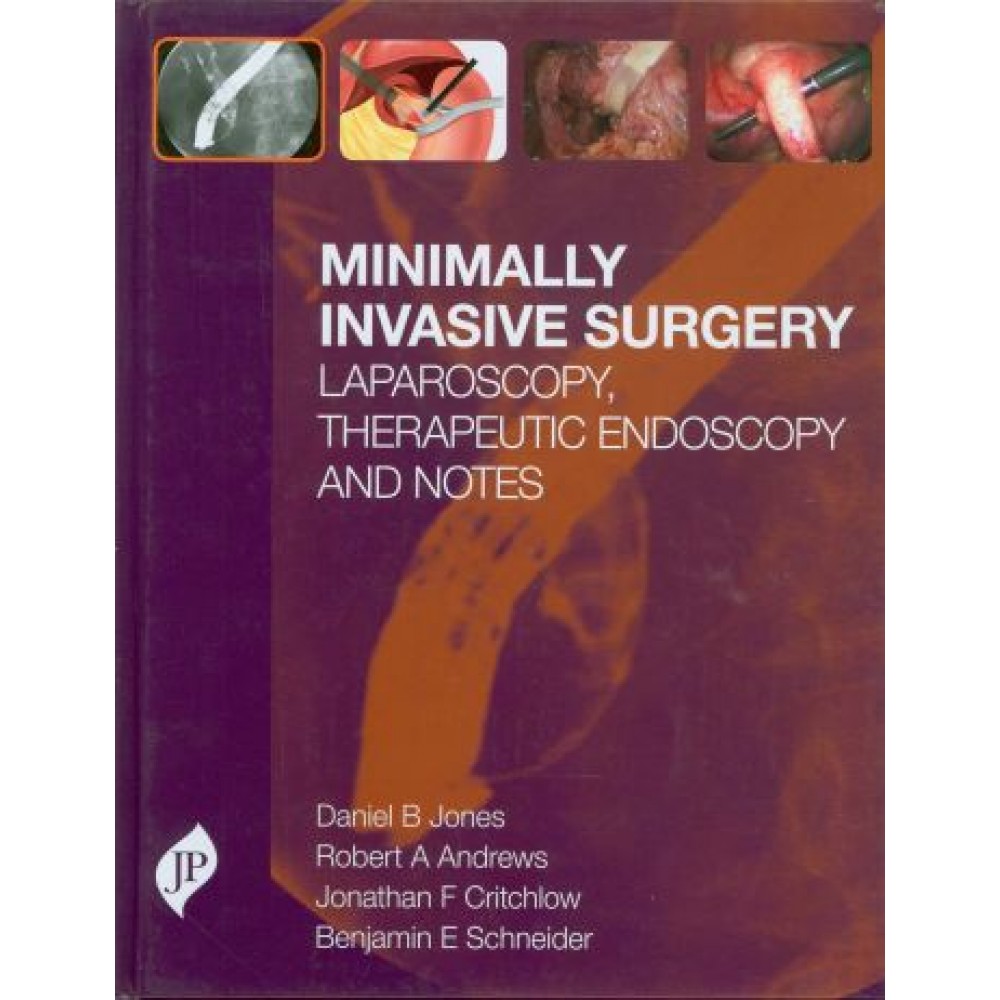 Minimally Invasive Surgery