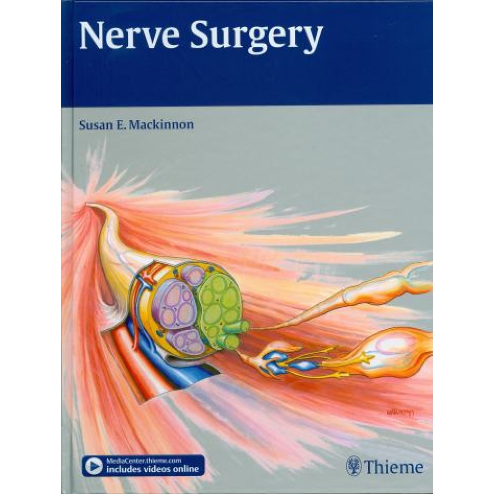 Nerve Surgery