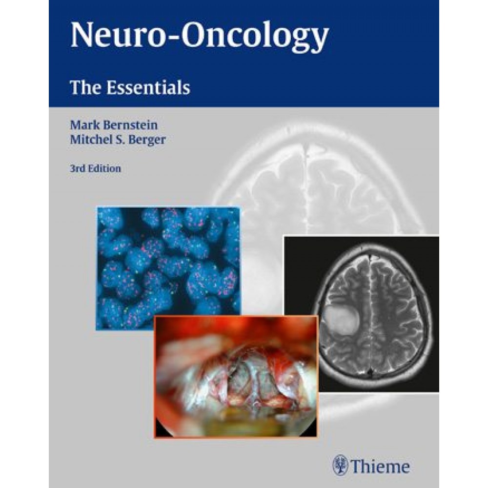 Neuro-Oncology: The Essentials, 3rd edition