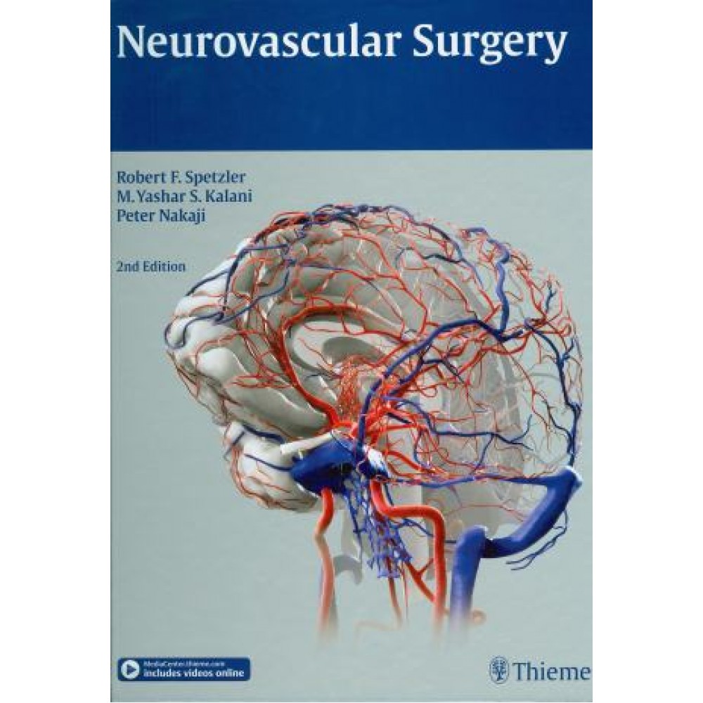 Neurovascular Surgery, 2nd Edition