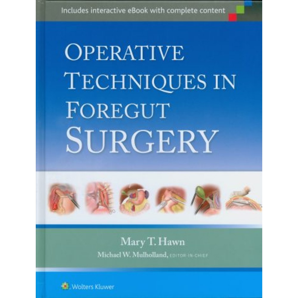 Operative Techniques in Foregut Surgery