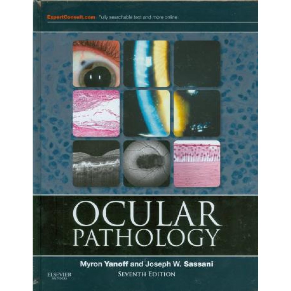Ocular Pathology, 7th Edition