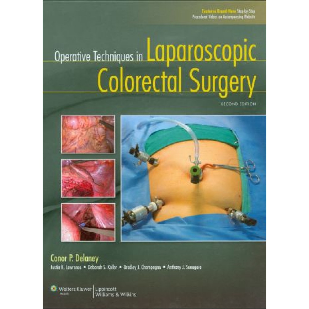 Operative Techniques in Laparoscopic Colorectal Surgery, 2nd Edition