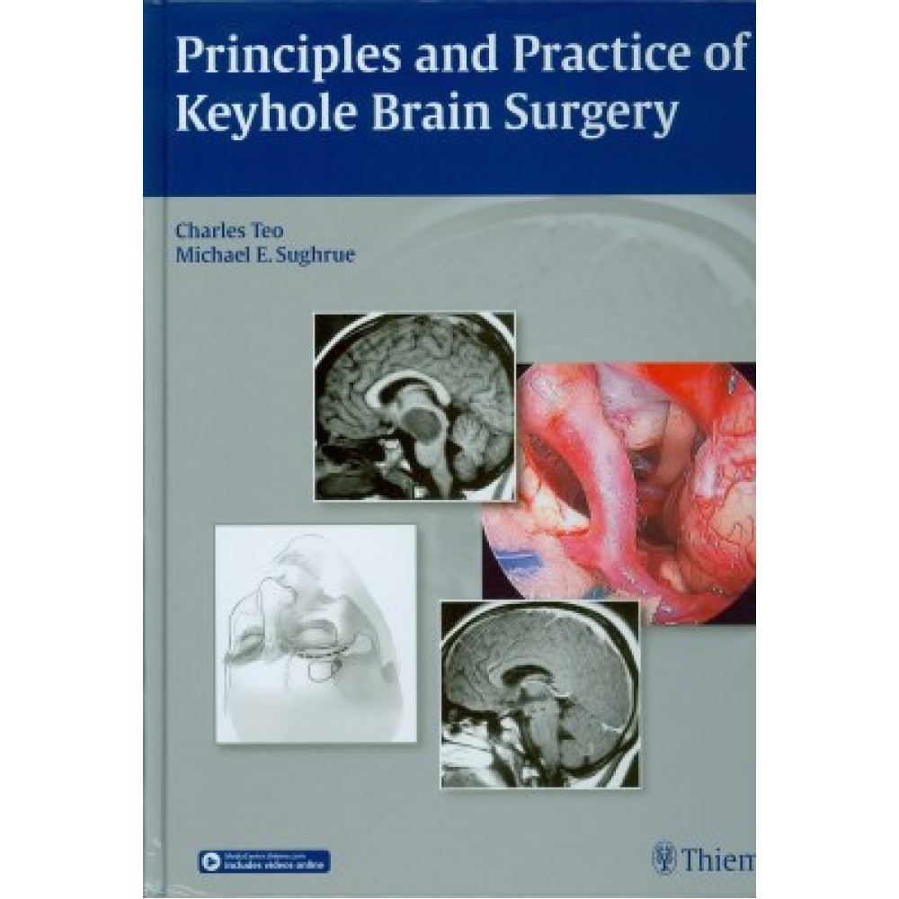 Principles and Practice of Keyhole Brain Surgery