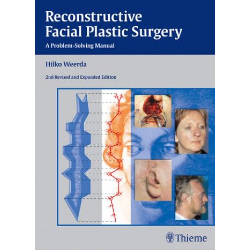 Reconstructive Facial Plastic Surgery, 2nd Edition