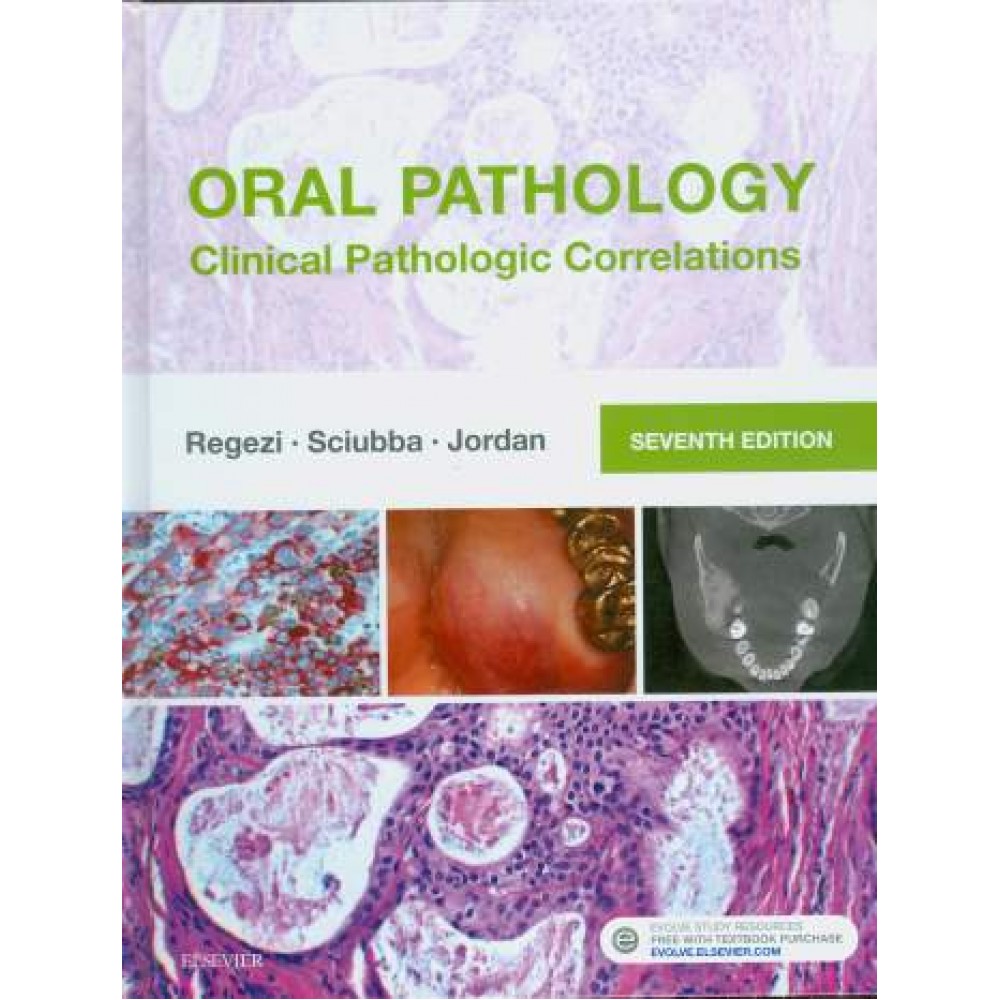 Oral Pathology: Clinical Pathologic Correlations, 7th Edition