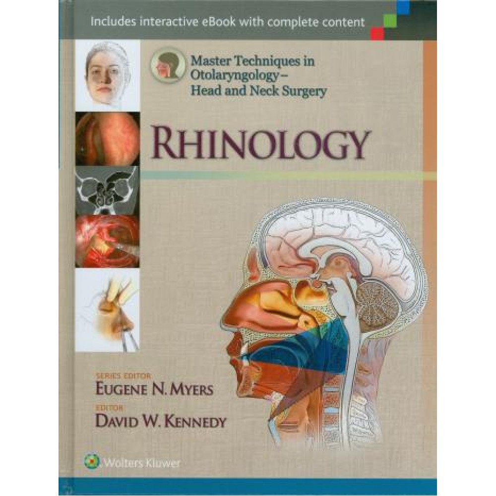 Head and Neck Surgery: Rhinology