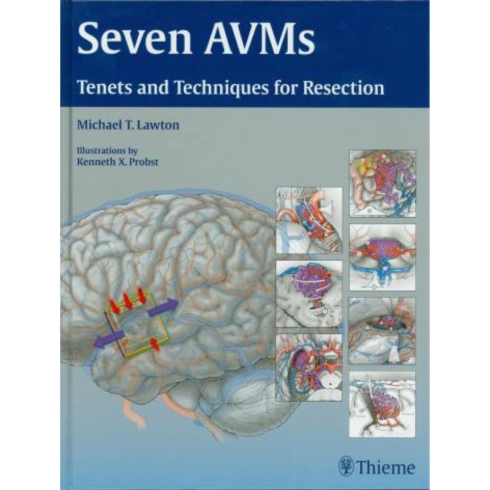 Seven AVMs