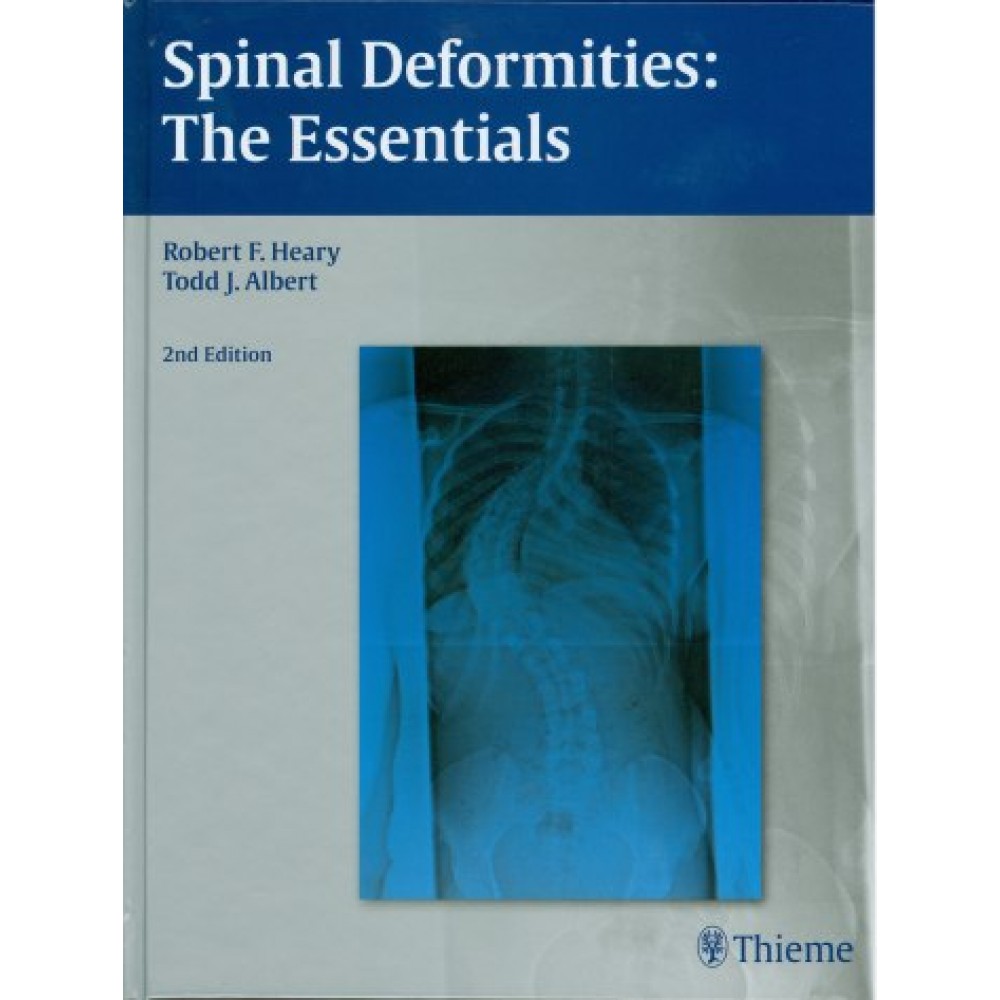 Spinal Deformities : The Essentials, 2nd Edition