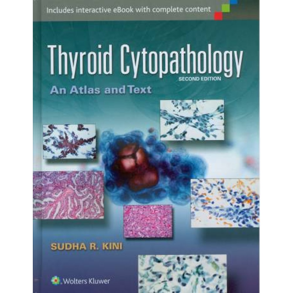 Thyroid Cytopathology: An Atlas and Text, 2nd Edition