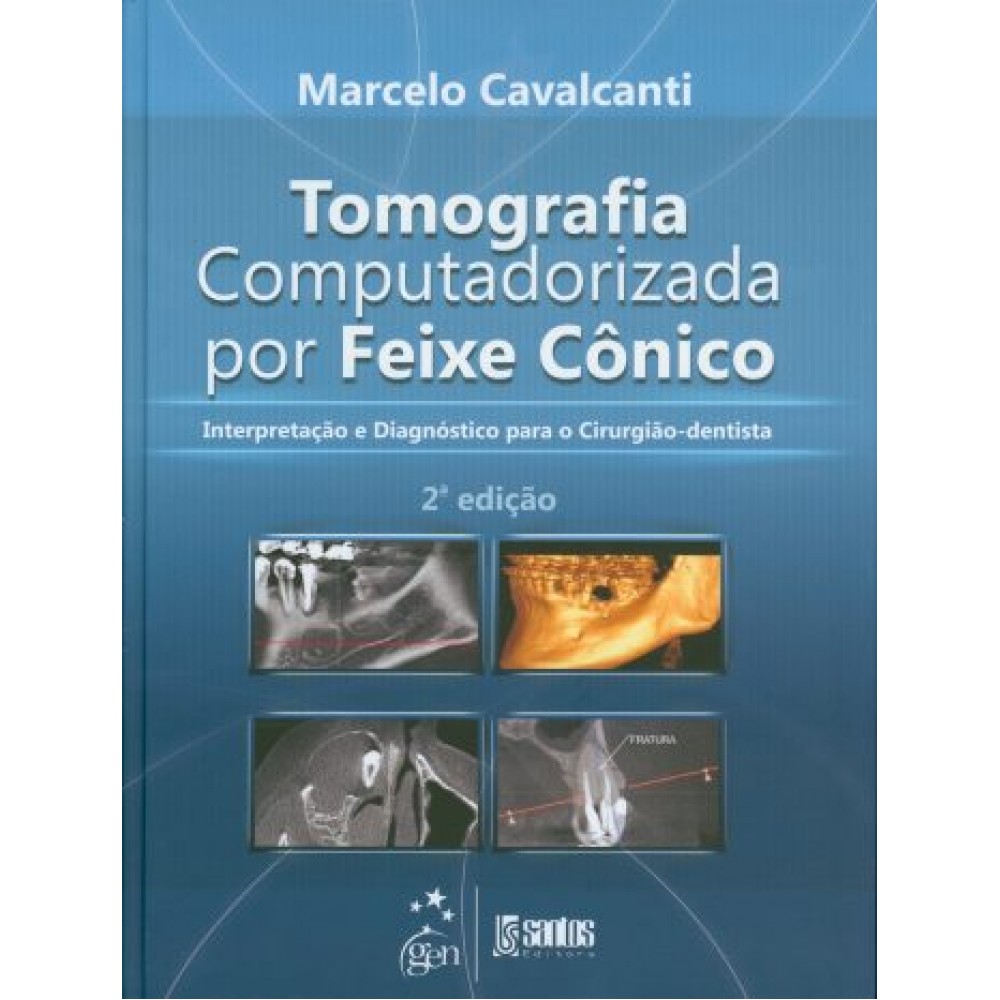 Tomografia Computadorizada por Feixe Cônico, 2ª Edição