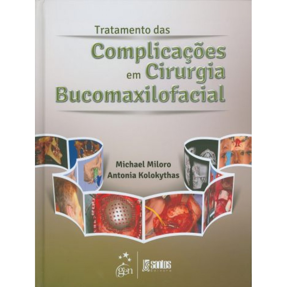 Tratamento das Complicações em Cirurgia Bucomaxilofacial