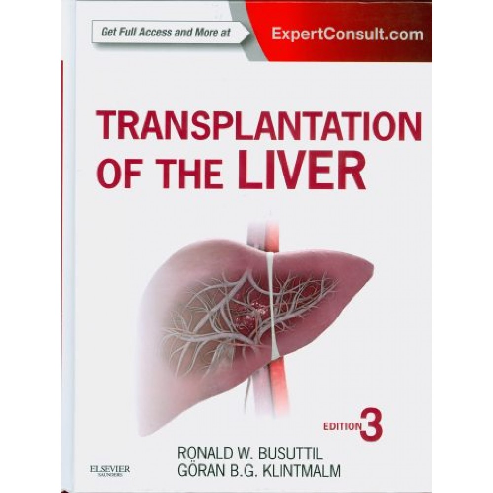 Transplantation of the Liver, 3rd Edition