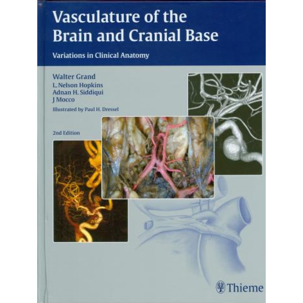Vasculature of the Brain and Cranial Base, 2nd Edition