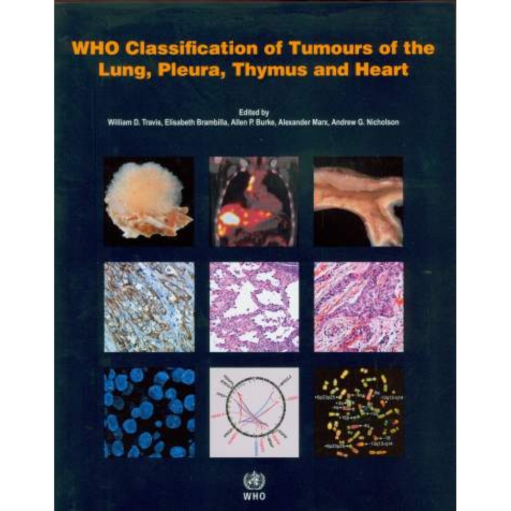 WHO Classification of Tumours of the Lung, Pleura, Thymus and Heart, 4th Edition