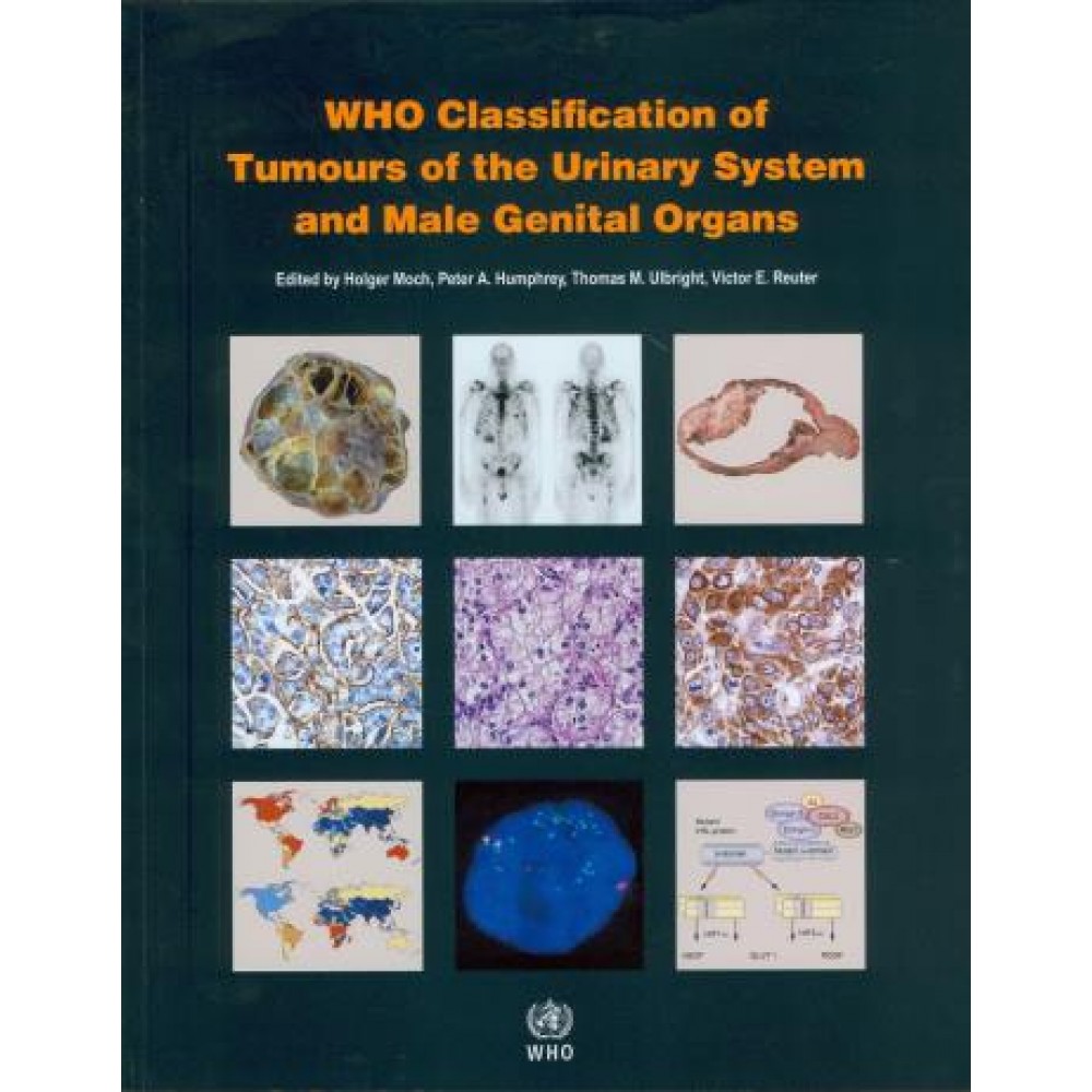 WHO Classification of Tumours of the Urinary System and Male Genital Organs, 4th Edition