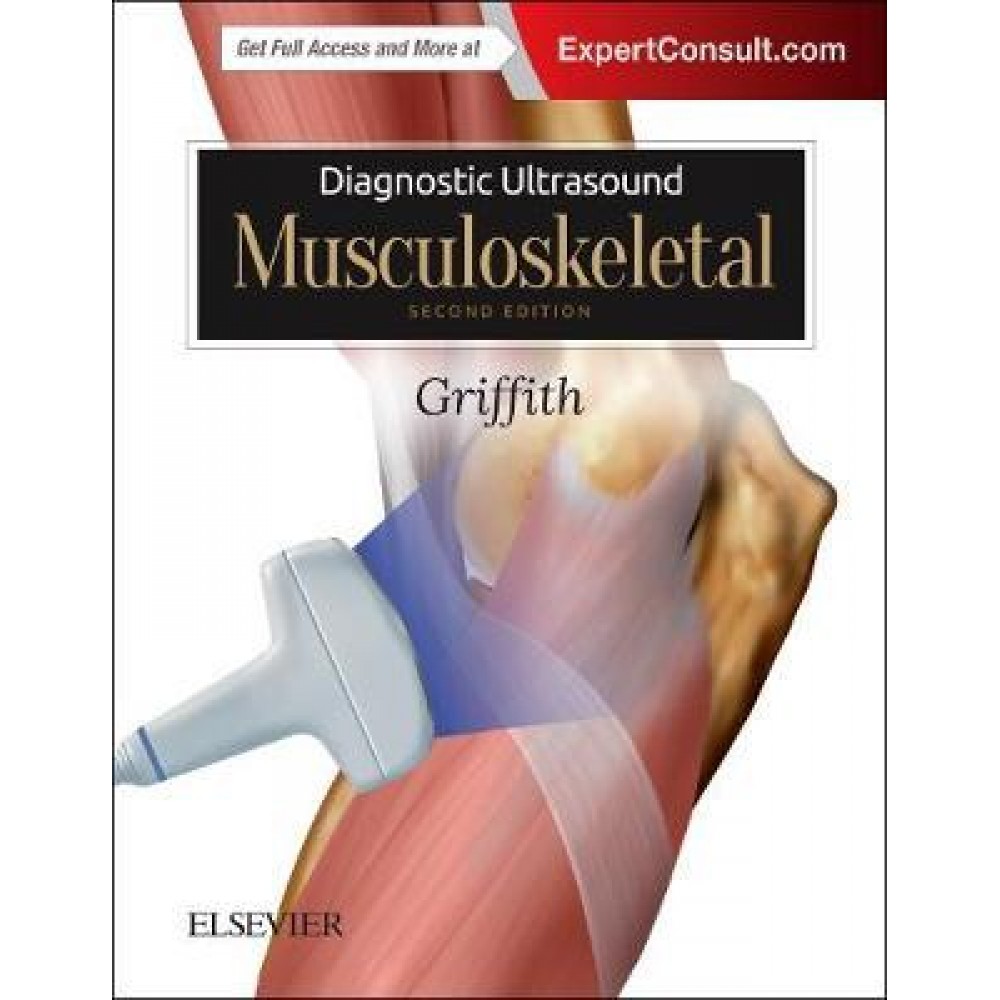 Diagnostic Ultrasound: Musculoskeletal 2ed 