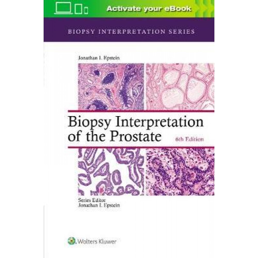 Biopsy Interpretation of the Prostate 6ed