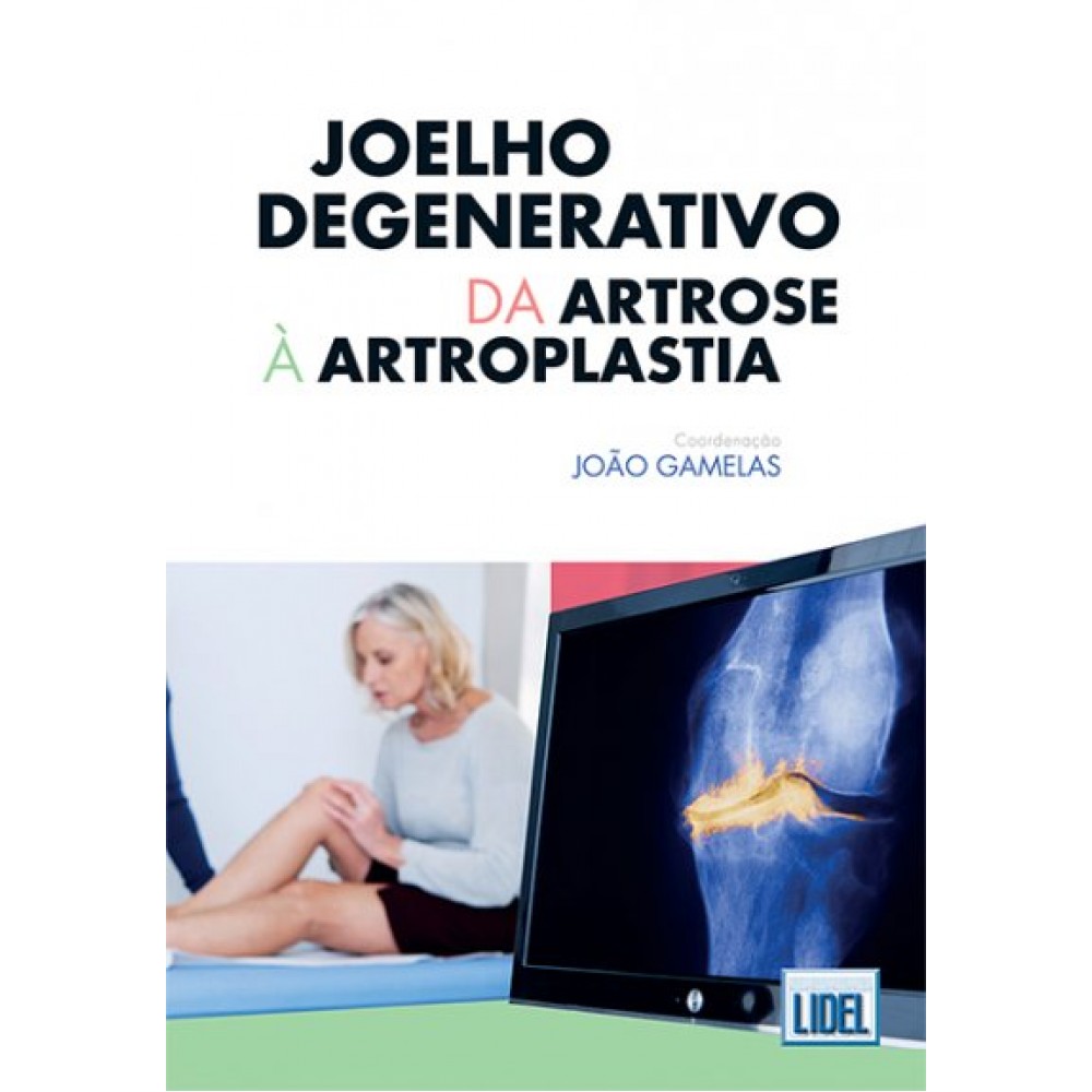 JOELHO DEGENERATIVO: DA ARTROSE À ARTROPLASTIA