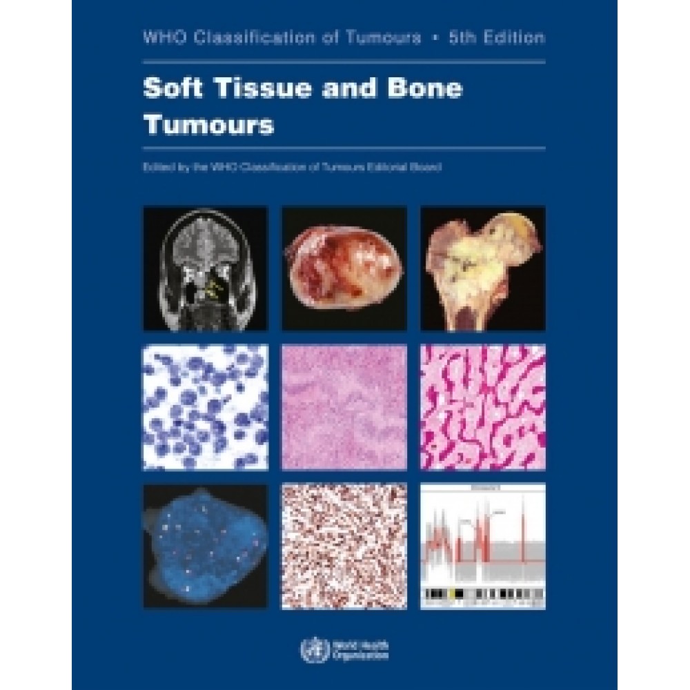 Soft Tissue and Bone Tumours 5ed 